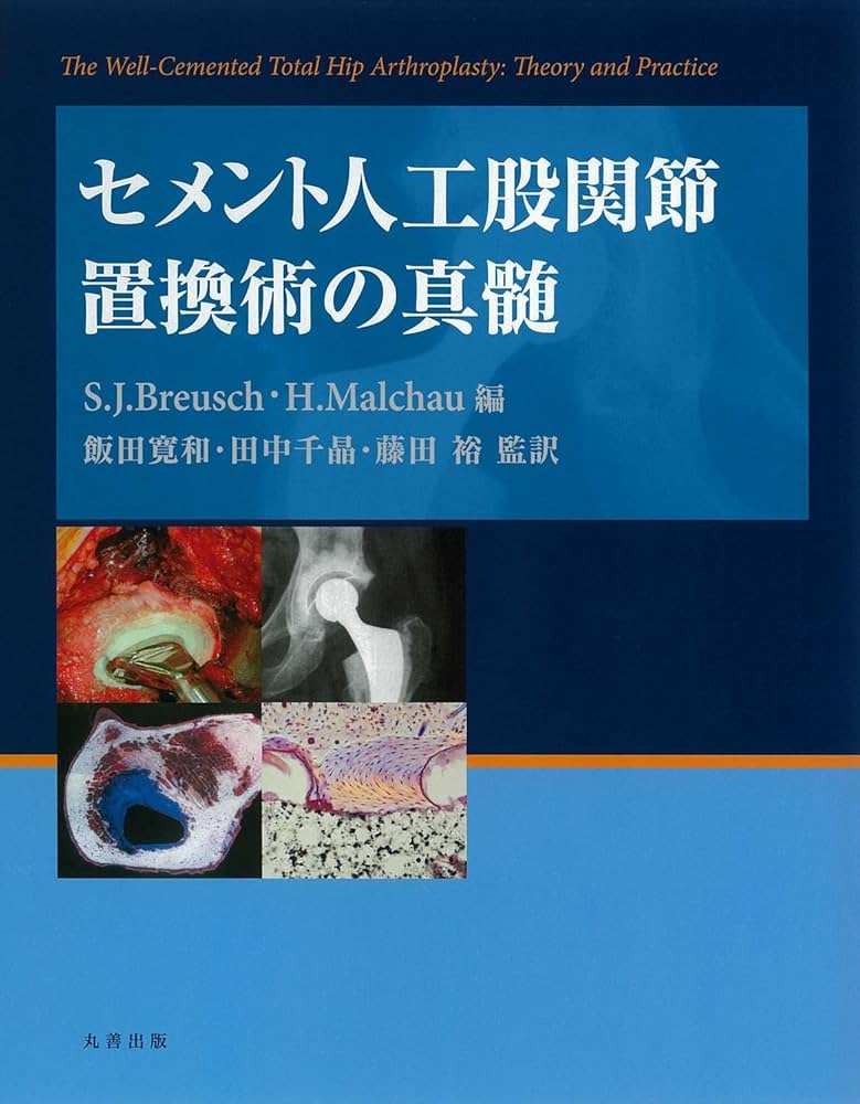 セメント人工股関節置換術の真髄 Amazon.co.jp: セメント人工股関節置換術の真髄 : 飯田 寛和: 本